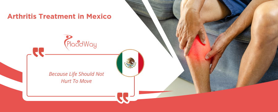 Arthritis Treatment in Mexico