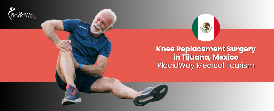 Reemplazo de Rodilla en Tijuana - Recupere la Salud de sus Rodillas
