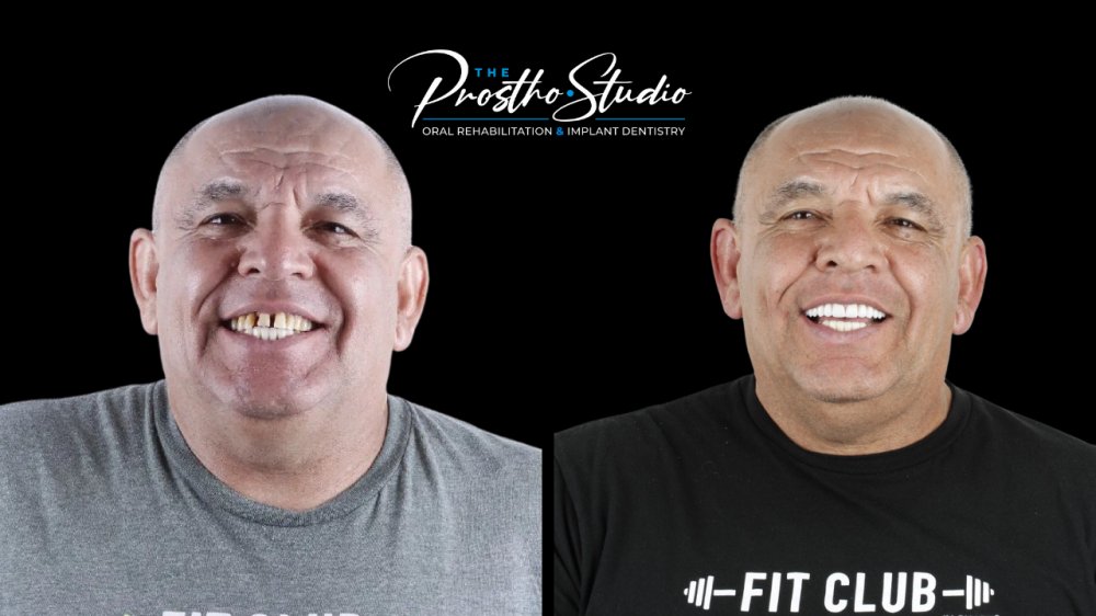 The Prostho Studio