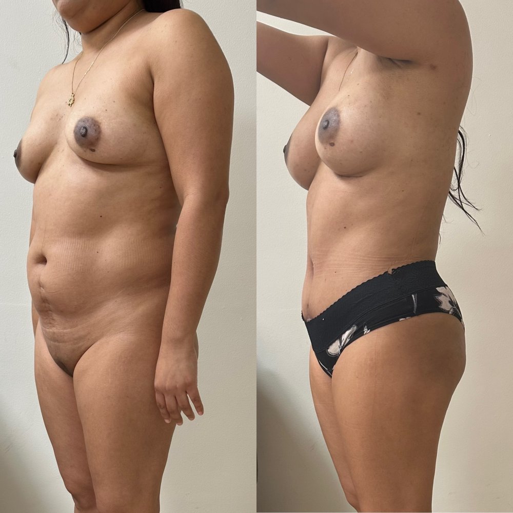 Dr. Gabriel Sandoval - Plastic Surgeon in Mexico