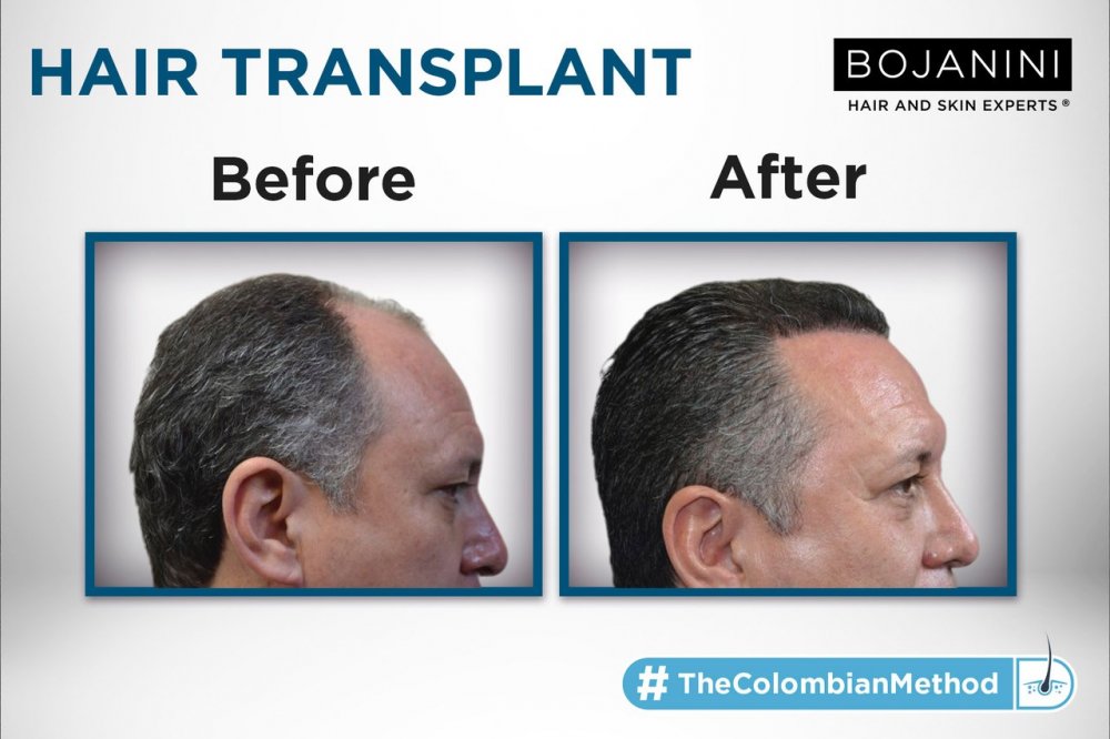 BOJANINI HAIR & SKIN EXPERTS CANC