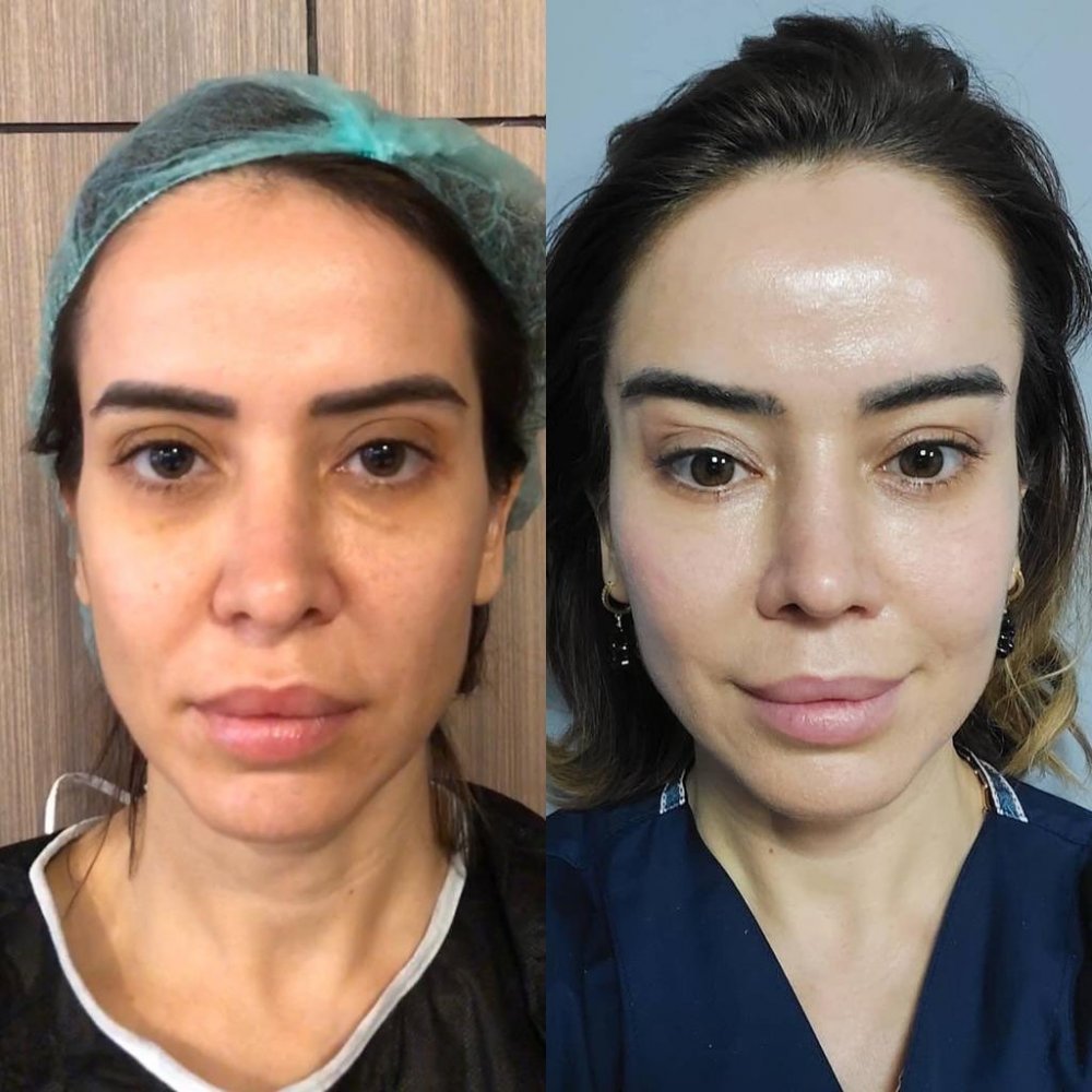 Dr. Alper Tuncel - Plastic Surgery