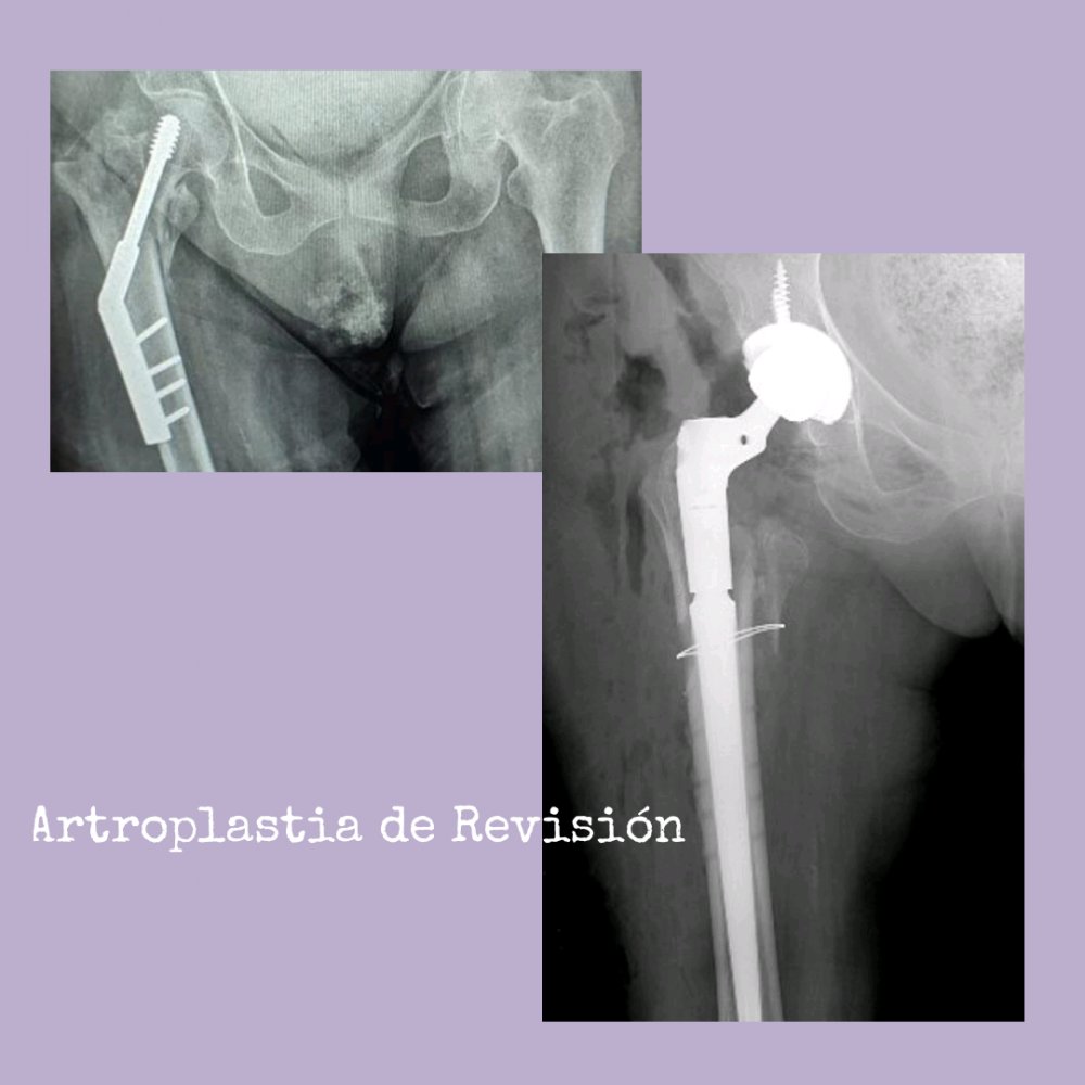 Dr. Rodrigo Aguirre Rojas Orthopedic Surgeon in Mexico