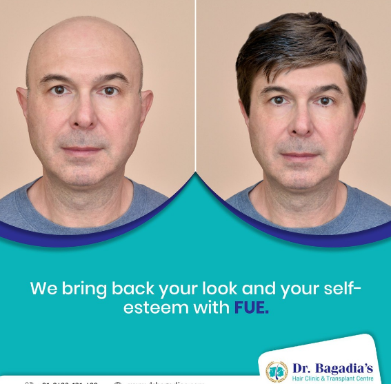 Dr. Bagadia’s Hair Clinic & Transplant Centre