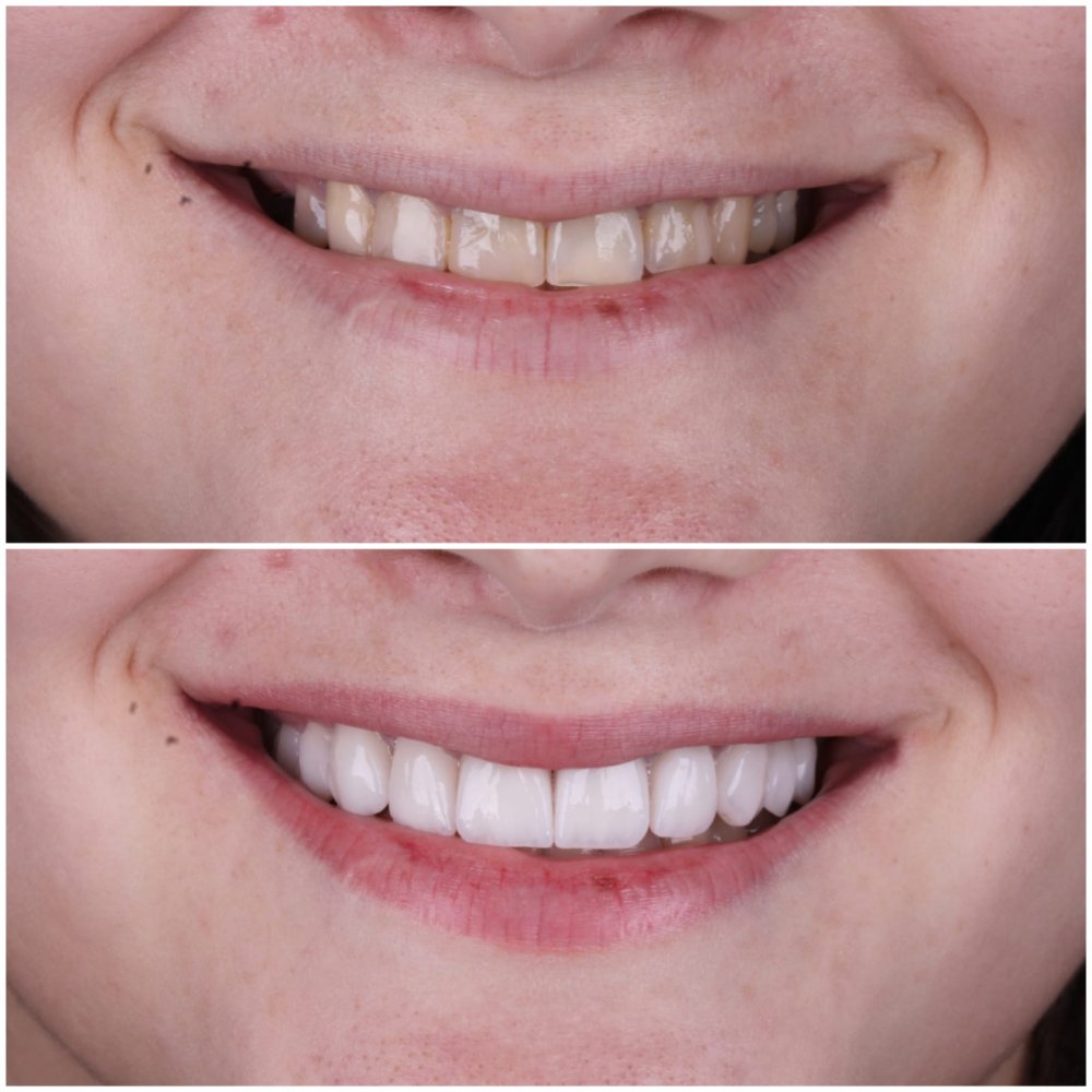 Odonto Liuzzi - Dental Clinic in Rio de Janeiro, Brazil