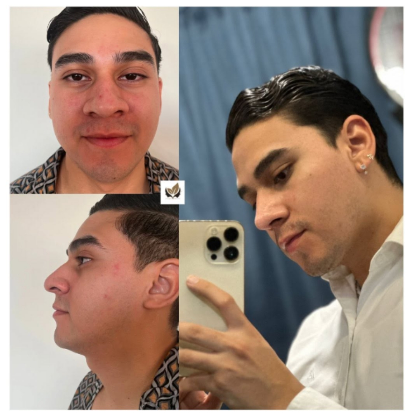 Dr. Israel Villalobos - Plastic Surgery in Tijuana Mexico