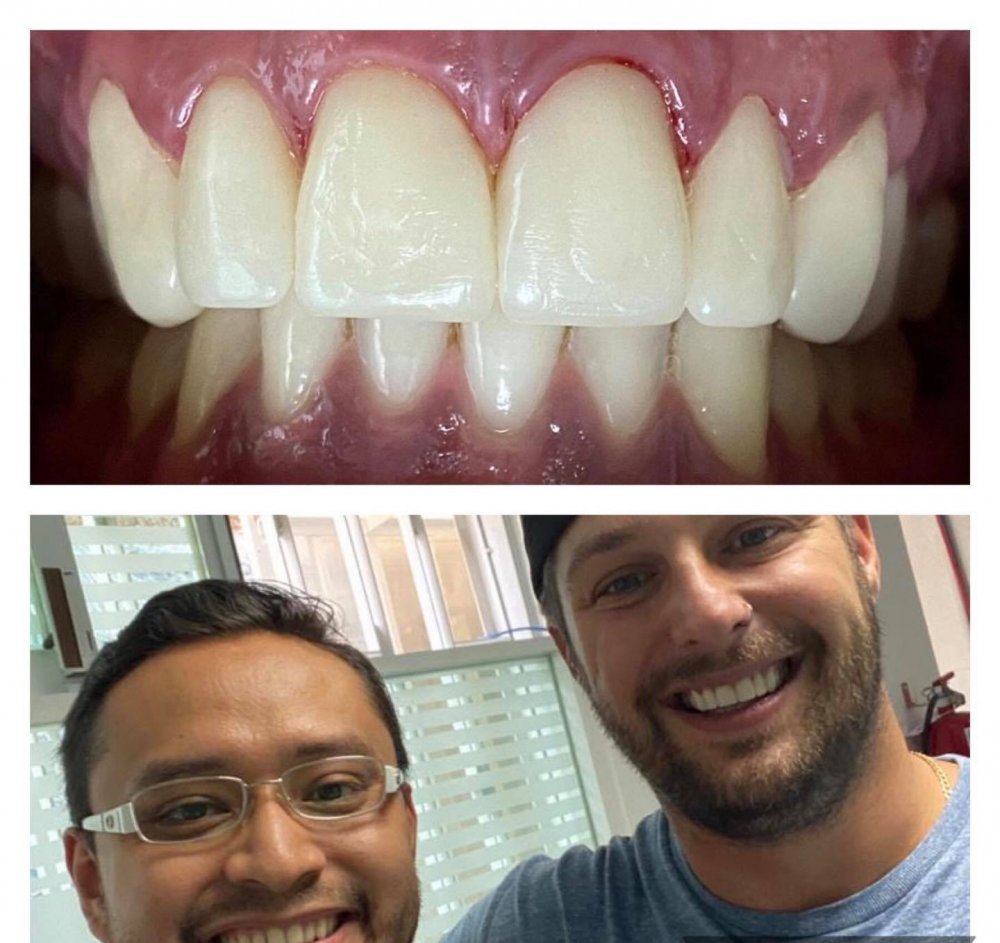 Ideal Dental Mexico City