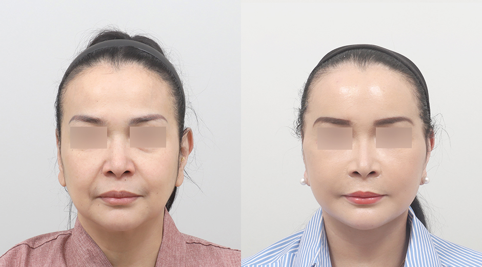 AB Plastic Surgery