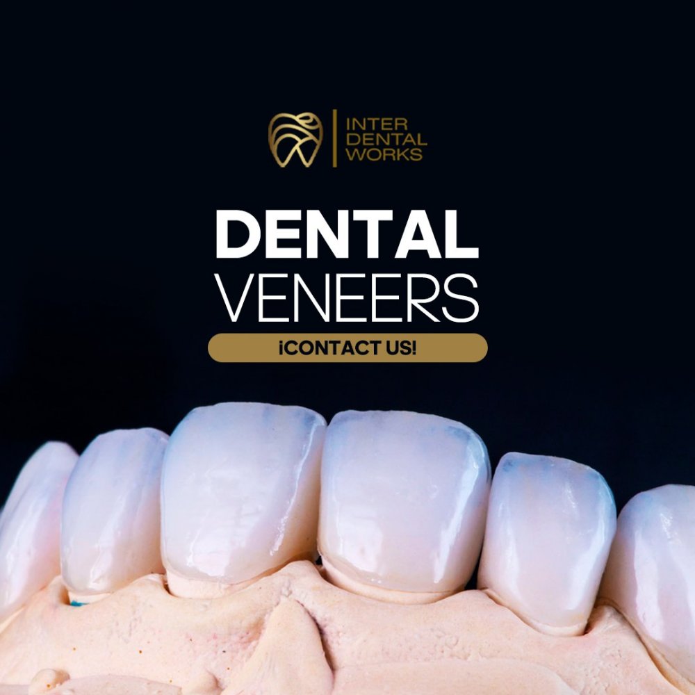 Inter DentalWorks