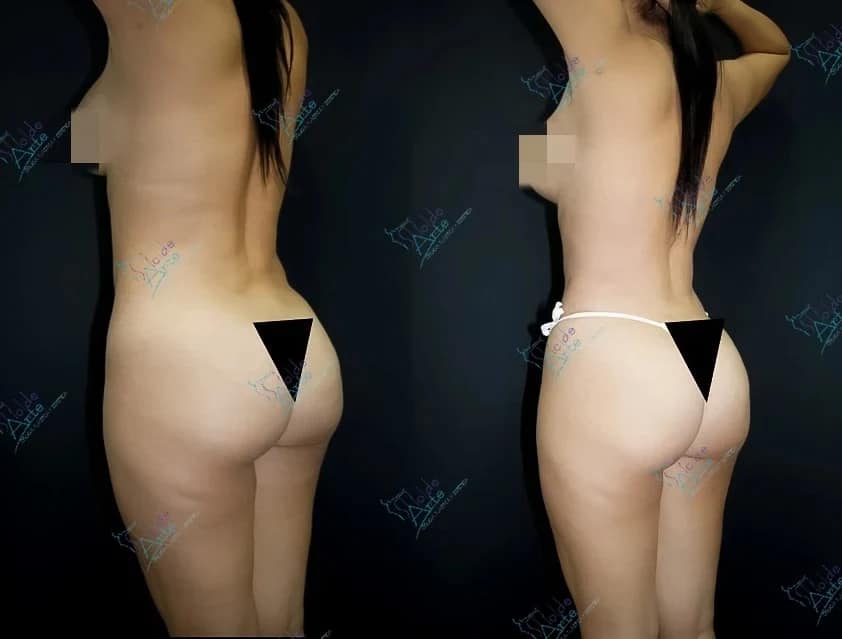 Dr. Fernando Munar - Plastic Surgery