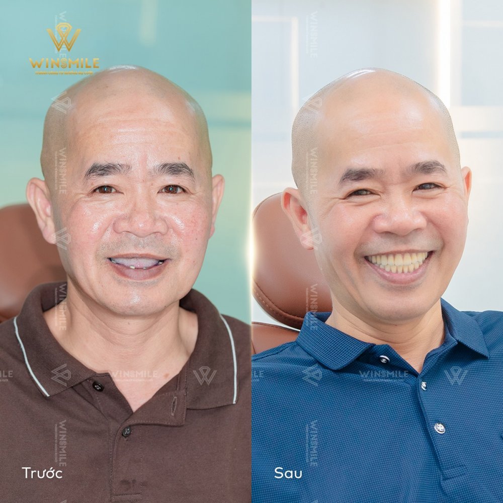 WinSmile Dental Clinic Vietnam
