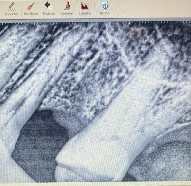 Smiletec® - Leading Mexicali Dental Clinic