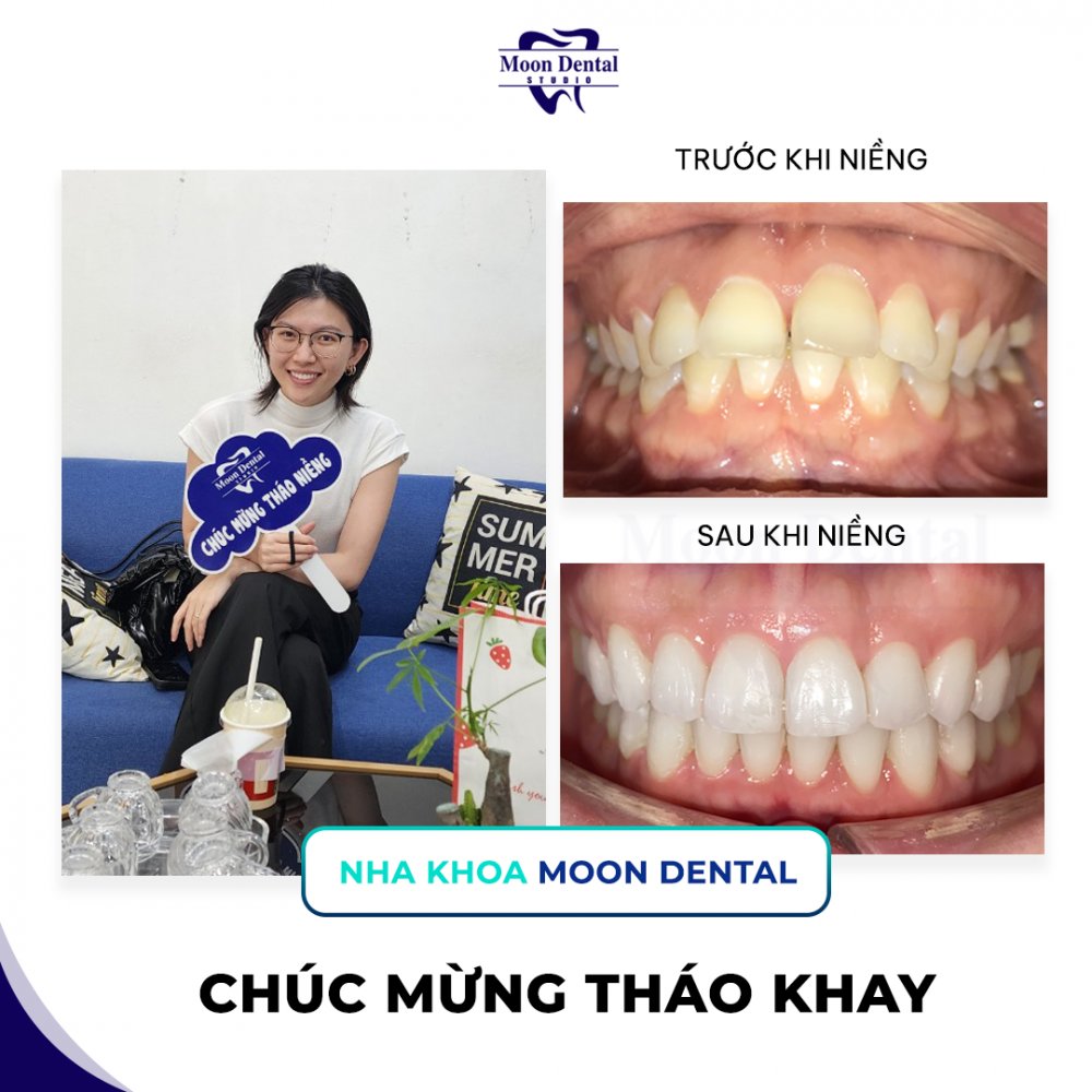 Nha Khoa Moon - Dental Clinic in Vietnam