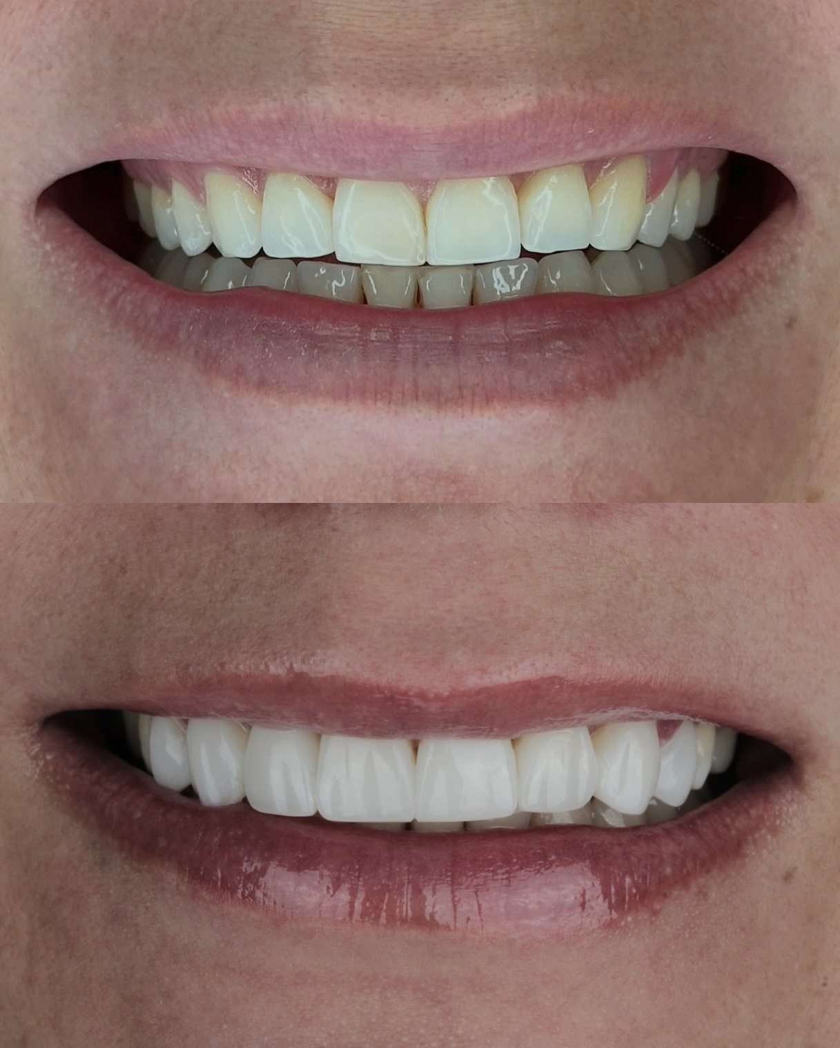 Smile Atelier by Dr. Roberto Tamara - Dental Clinic in Colombia