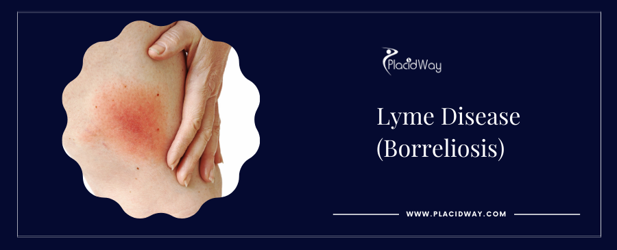 Lyme Disease Treatment Abroad: Find Relief & Expert Care
